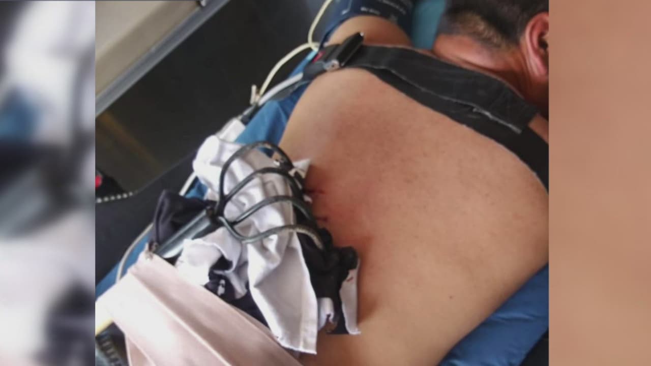 En exclusiva: Hombre del valle dice haber sido víctima de un “ataque de odio” mientras trabajaba