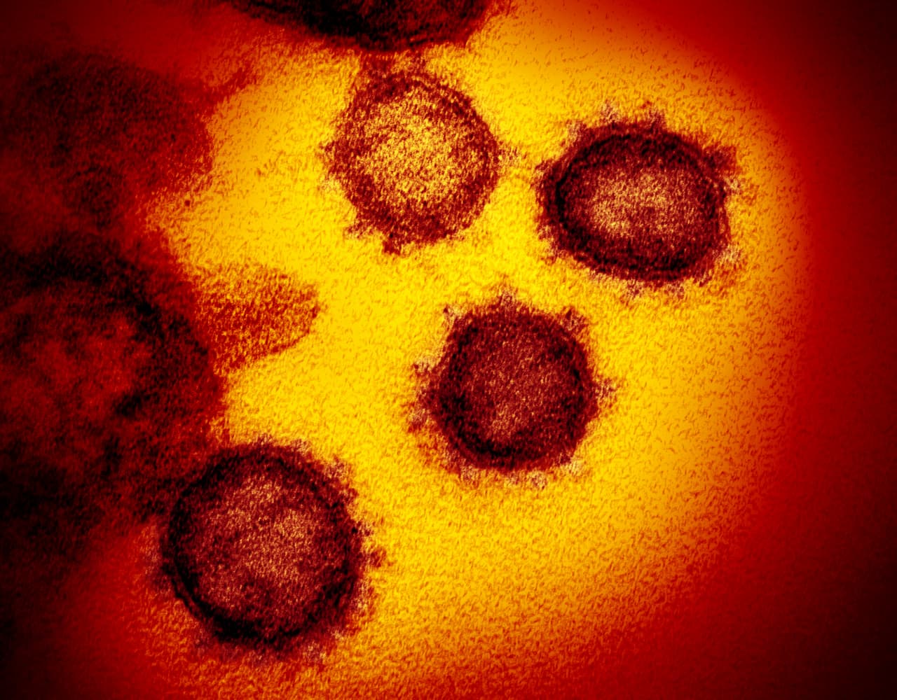<b>11 de marzo de 2020: la OMS declara la propagación del nuevo coronavirus como una pandemia. </b>
<br>
<br>Hasta ese día 114 países habían informado que 118,000 habían contraído la enfermedad y se registraban apenas 4,300 fallecidos en el mundo. Las primeras fotografías del coronavirus fueron publicadas en febrero por el
<a href="https://www.niaid.nih.gov/news-events/novel-coronavirus-sarscov2-images"> Instituto Nacional de Alergias y Enfermedades Infecciosas de EEUU</a>, y
<a href="https://www.univision.com/noticias/salud/las-razones-del-nombre-del-coronavirus-7-impresionantes-imagenes-que-te-lo-explican-fotos"><u>muestran la corona que le da su nombre</u></a>.
<br>
<br>En ese momento, la cantidad de pruebas que se realizaban en Estados Unidos era limitada y se habían diagnosticado alrededor de 1,000 casos, con unas tres decenas de fallecidos.