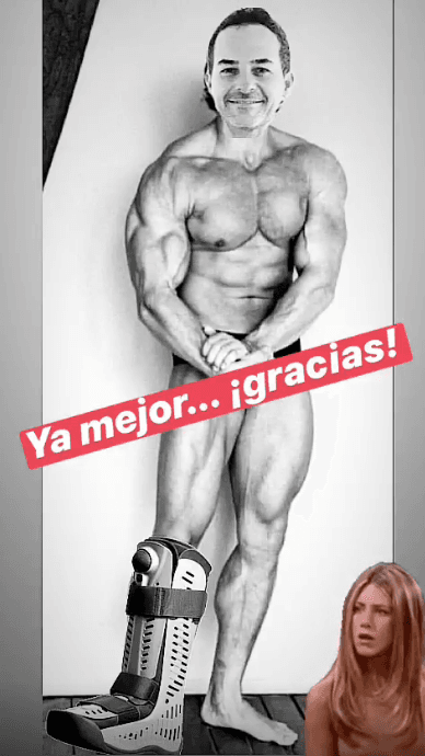 Después de semanas ausente del show y de las redes sociales, Carlos Calderón dio señales de vida al hacer algunas graciosas publicaciones en su cuenta de Instagram. Una de ellas fue un montaje en el que muestra que la recuperación del talón iba mejorando, y que además estuvo ganando músculo.