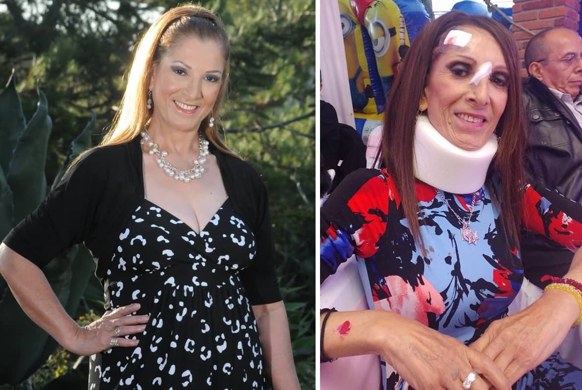 Viola Dorantes, hermana de Paquita la del Barrio, sufre lesiones al caérsele un equipo de sonido en la cabeza