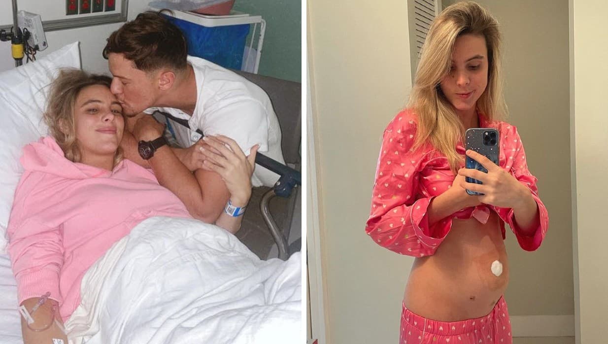 Lele Pons muestra los estragos en su abdomen tras someterse a una cirugía de apéndice
