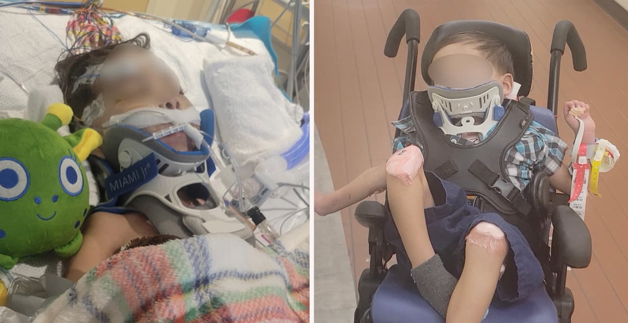 "Es un milagro": Menor de 3 años que recibió una golpiza por parte del novio de su madre sale del coma