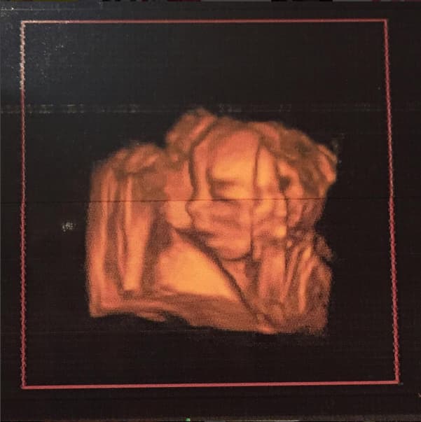 <b><a href="http://www.univision.com/temas/jacqueline-bracamontes">Bracamontes</a></b> aseguró que el más grande regalo que le ha dado la vida es el tener entre sus brazos a sus tres pequeñas hijas.