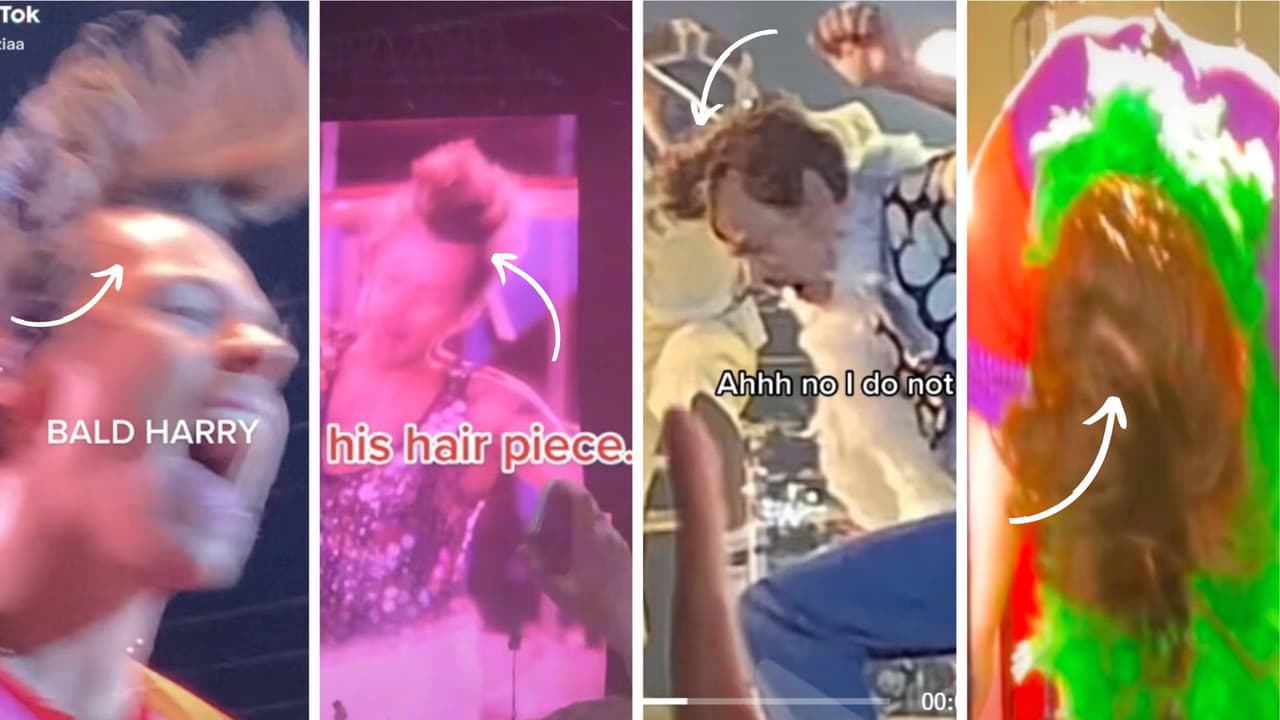 En TikTok existen fotografías que aseguran que Hary usa peluca