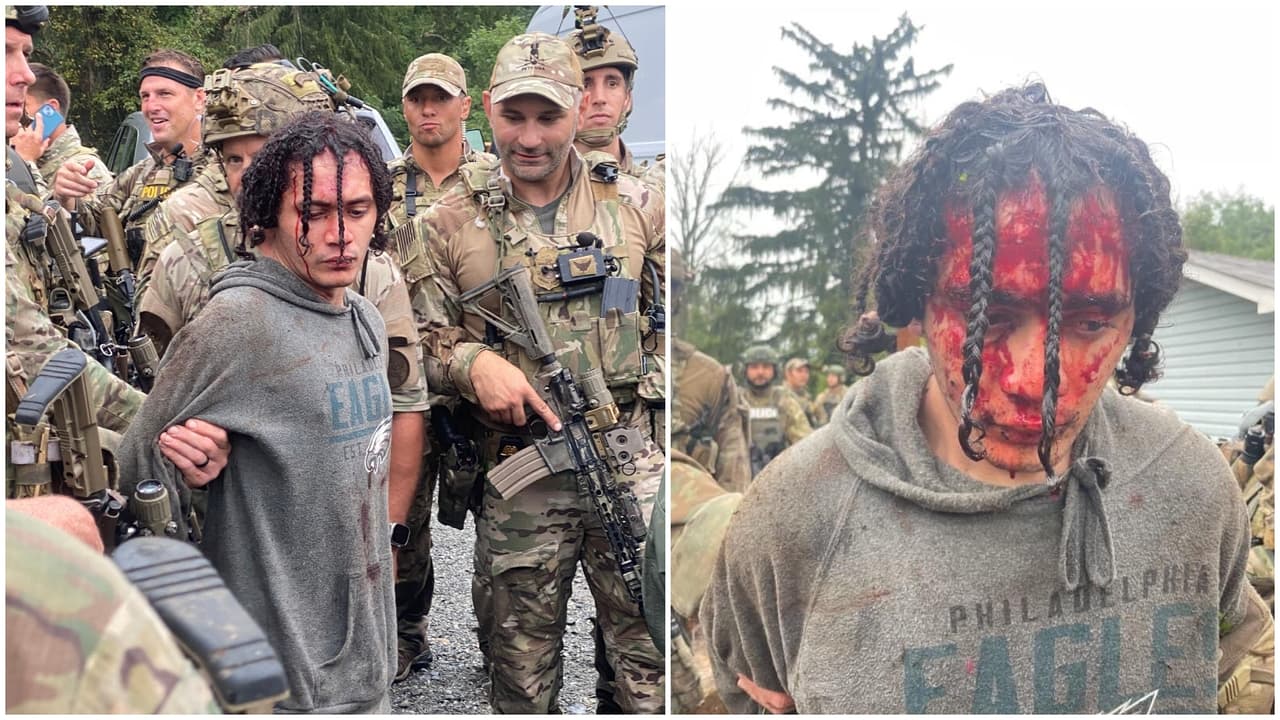 En la imagen derecha se ve a Cavalcante herido en su cuero cabelludo tras ser mordido por Yoda, un pastor belga malinois de 4 años miembro del equipo de Aduanas y Protección Fronteriza de El Paso, Texas.