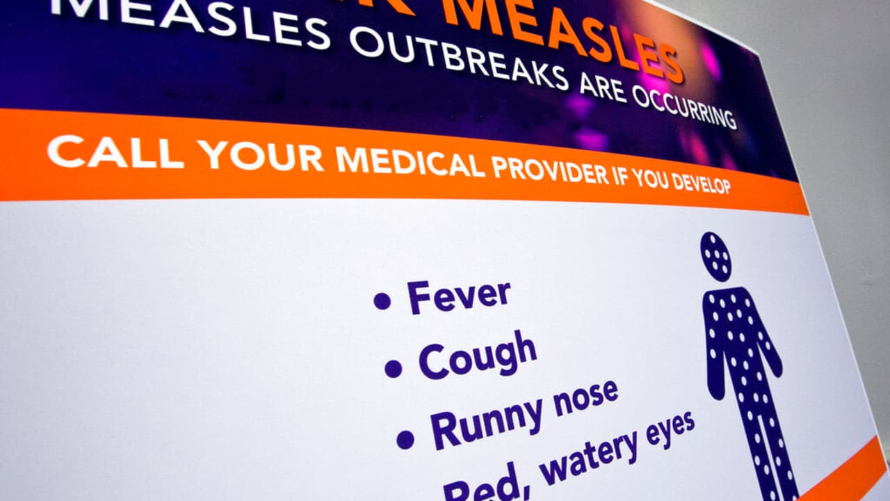 Primer caso de sarampión registrado en Florida: síntomas, cuidados y prevención