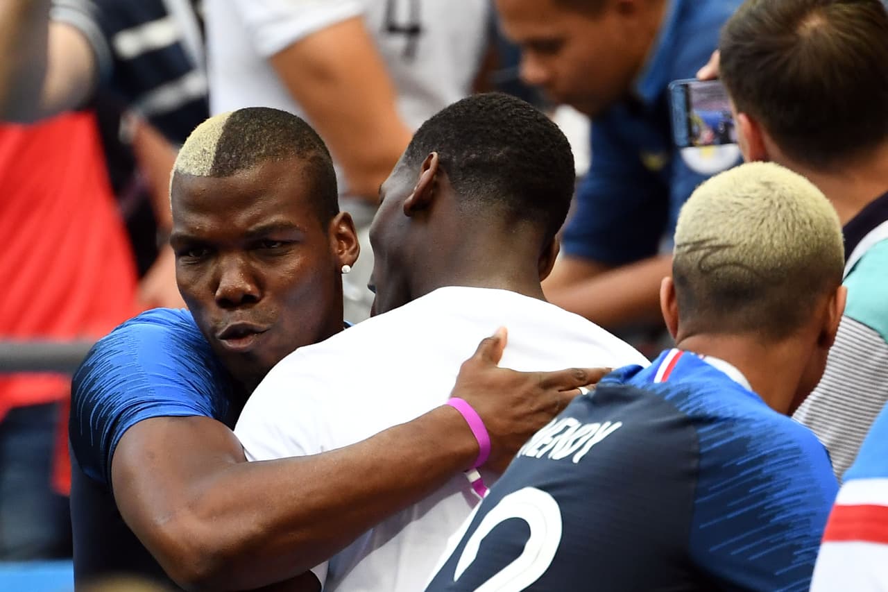 Paul Pogba de Francia quien ha usado su cabeza para llenarlo de simbolismos desde manchas de leopardo hasta un perfecto bicolor en el pelo.