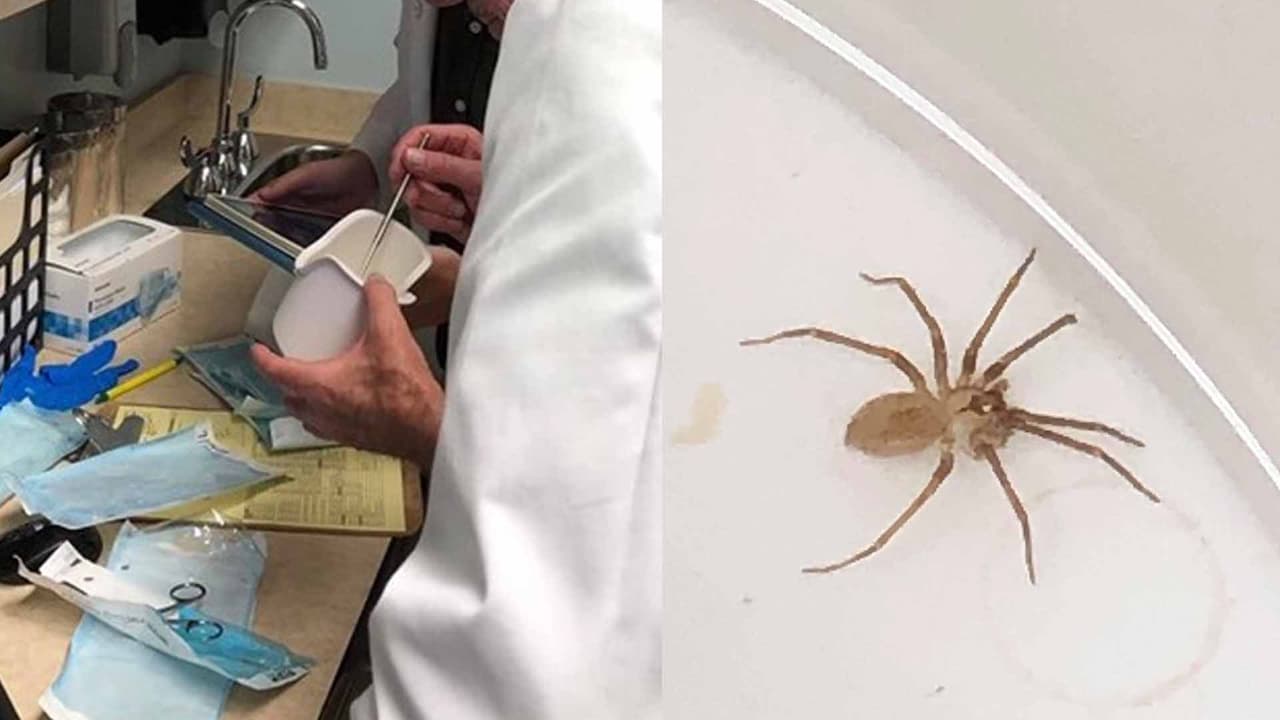 Va al doctor por dolor de oído y le extraen una araña venenosa