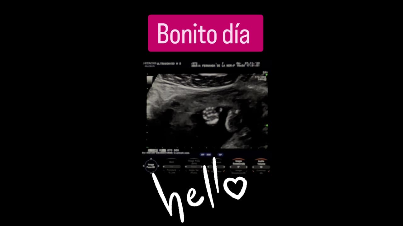 Luis 'Potro' Caballero dejó ver su emoción de su próxima paternidad