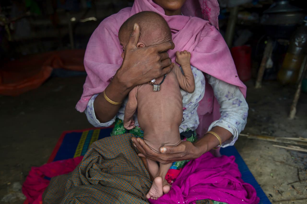 Una madre musulmana rohingya con su pequeño de tres meses visiblemente desnutrido. Voceros de las organizaciones no gubernamentales que han ayudado a los refugiados aseguran que se trata de una crisis humanitaria.
