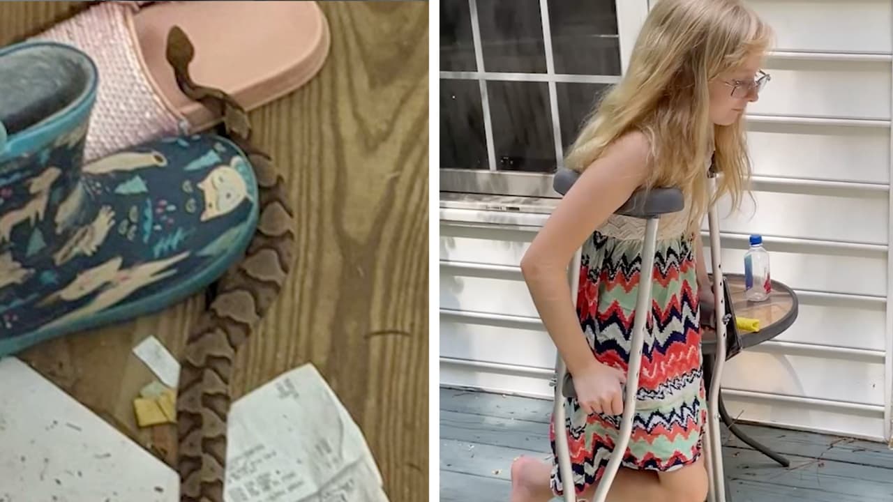 "Fue aterrador": serpiente cabeza de cobre ataca a una niña de 9 años