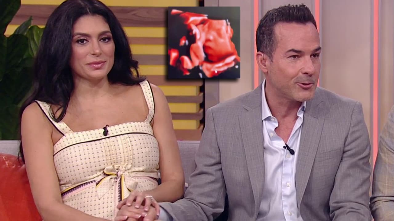 Los futuros papis también aprovecharon para mostrar las imágenes del ultrasonido donde se puede ver el rostro de ese bebé que esperan con tanta ilusión.