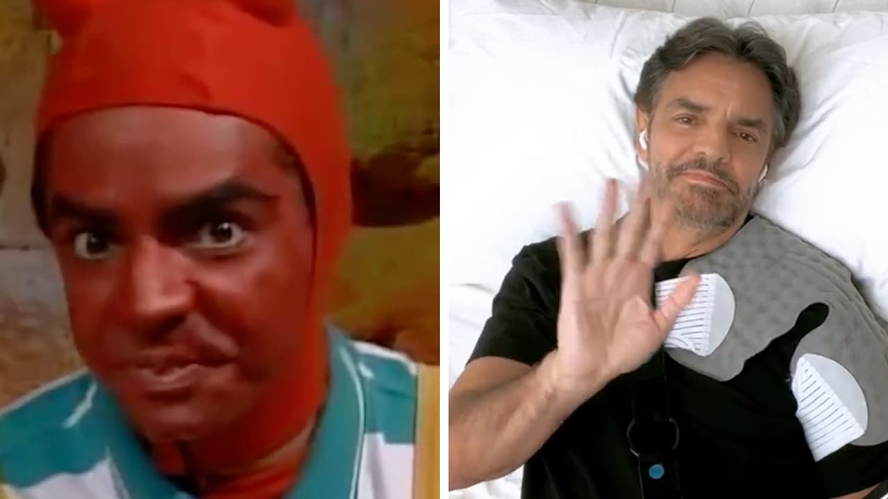 Eugenio Derbez ya toma con humor su accidente: hizo una "descripción gráfica"