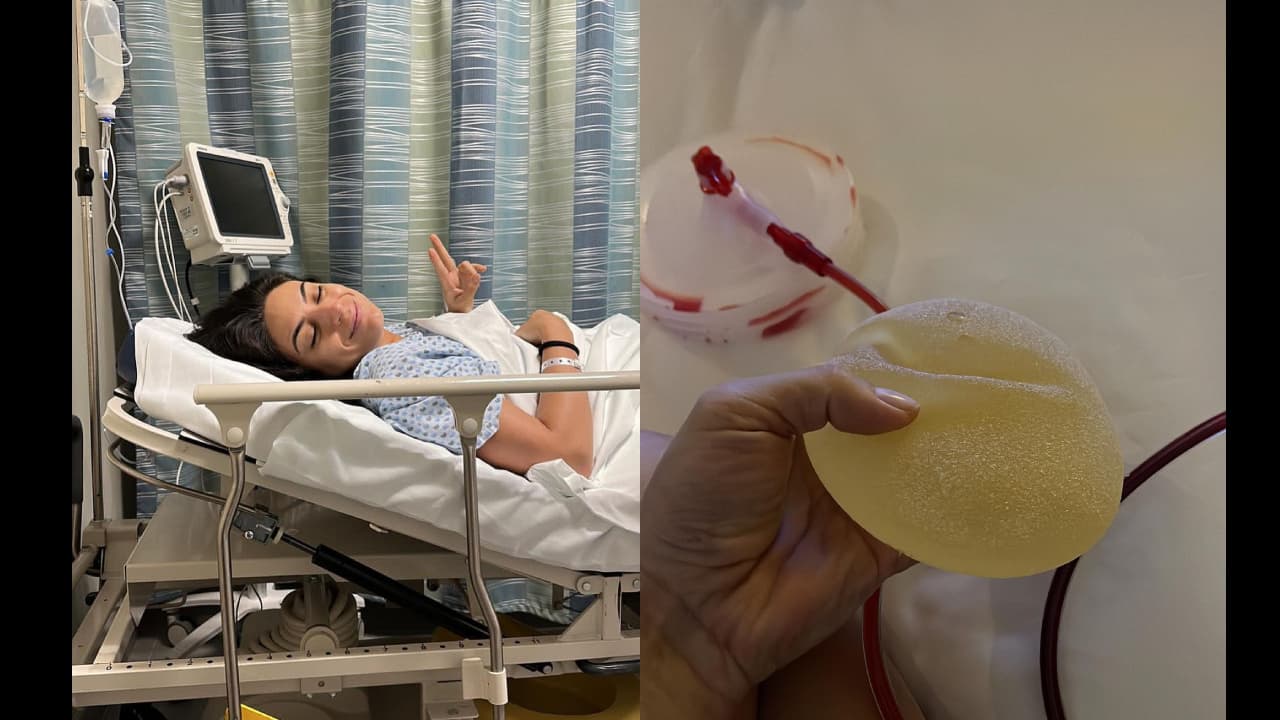 Ana Brenda mostró la cirugía que se realizó y reveló el motivo