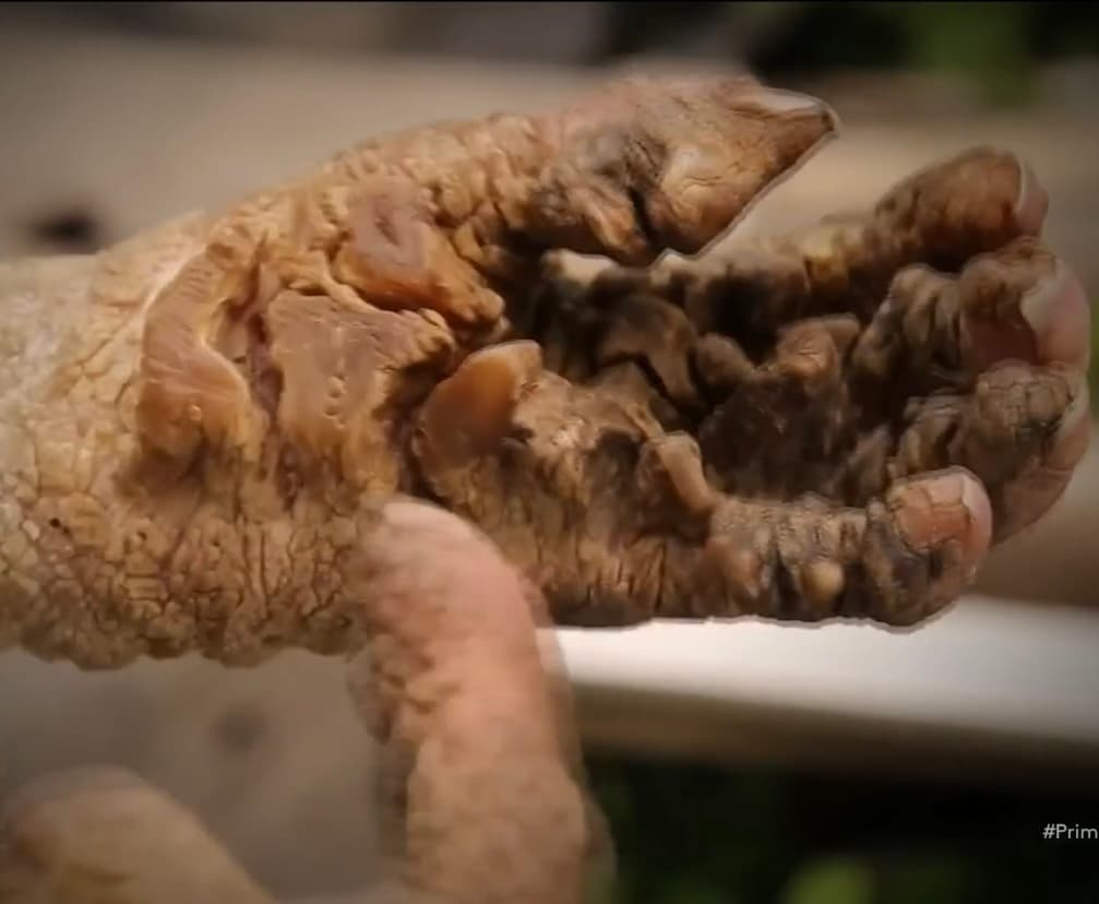 Sin embargo, a pesar de que su dolor lo supo aguantar en medio de una adolescencia solitaria, encerrada y discriminada, a tal grado que sus papás no la dejaron ir a la escuela, cuando supo que la hija que estaba por parir también sufriría los mismos males que tenía, sintió que su corazón se le paralizaba.