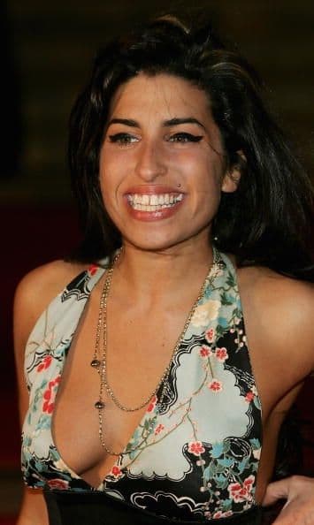 Un caso extremo de dentadura fea era la de Amy Winehouse. Muchos opinan que sus feos dientes se debían al estilo de vida lleno de drogas y tóxicos al que estaba acostumbrada.