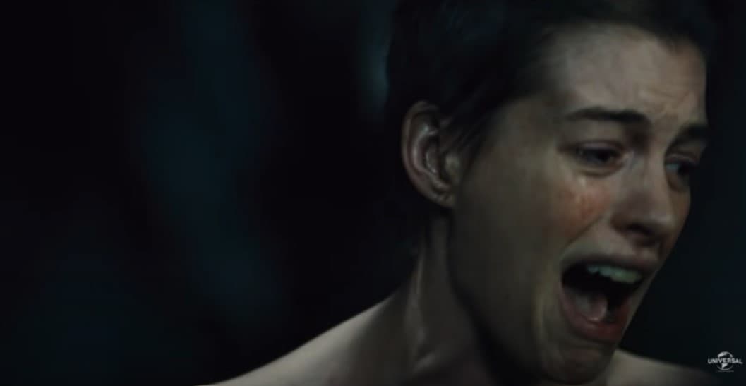 Anne Hathaway cambió en gran medida de aspecto en 'Los Miserables'