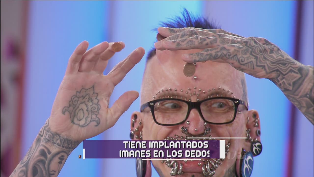 Además tiene implantes en los dedos.