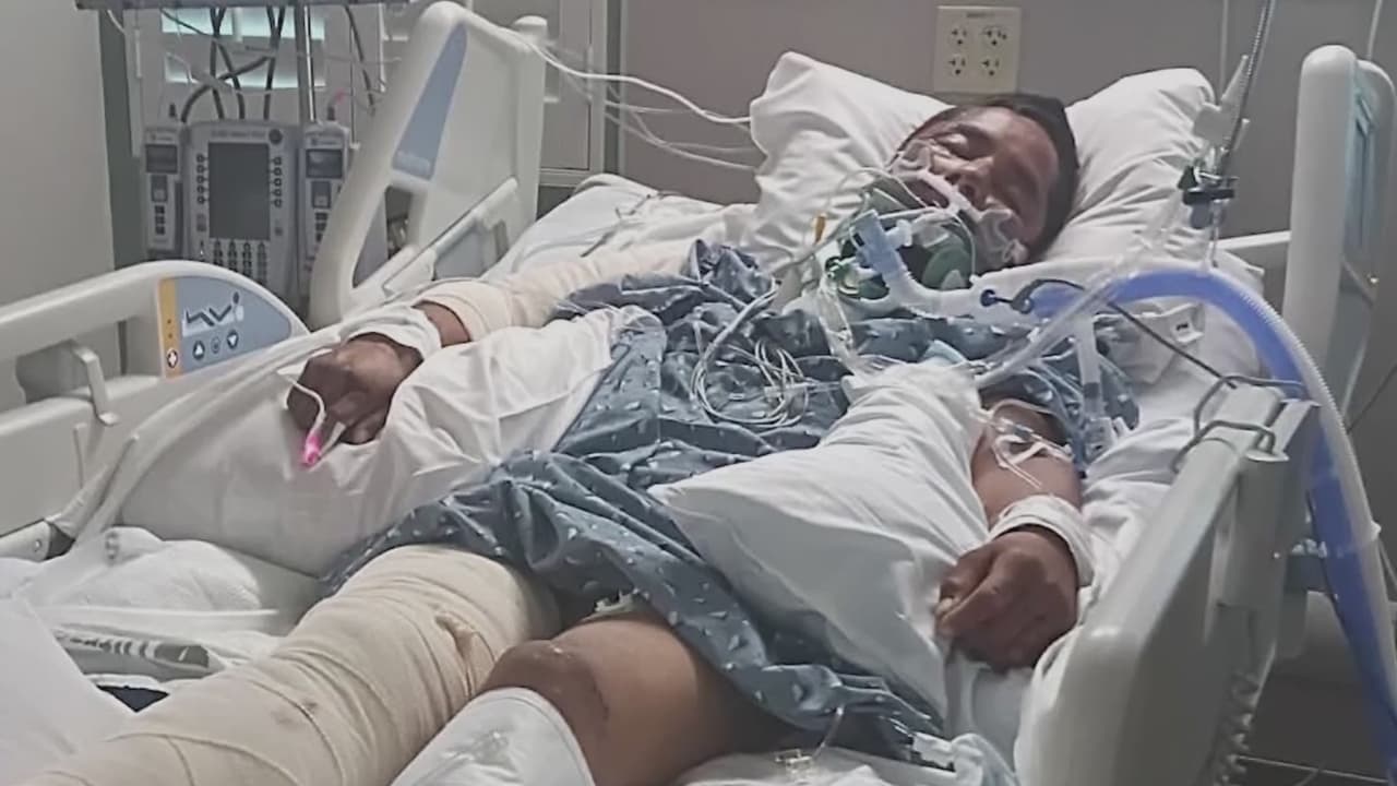Daniel Anthony Rosas lucha por su vida tras ser atropellado por alguien que se dio a la fuga