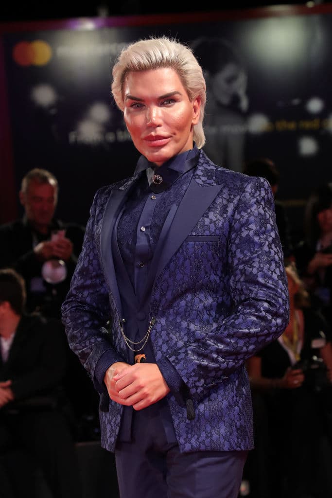 Durante años, el brasileño ocupó portadas de revistas y contenidos digitales, además de ser viral en redes sociales por sus más de 50 cirugías estéticas.