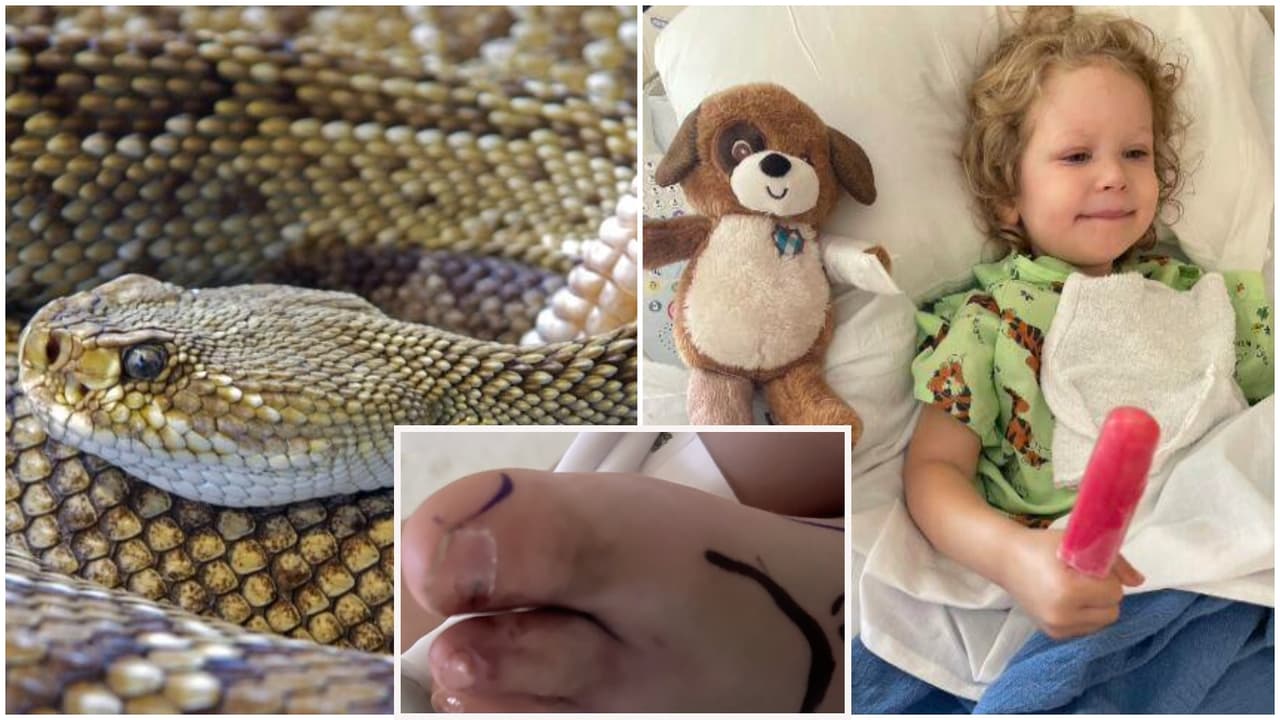 Víbora de cascabel muerde a niña de 3 años y la manda al hospital