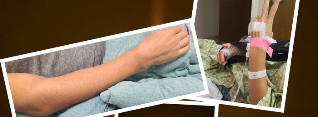 "Le pusieron una placa en la muñeca. El húmero y el radio estaban totalmente desfasados y el codo, le tuvieron que poner un codo de titanio y arreglarlo".