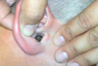 Gross Moth In Ear