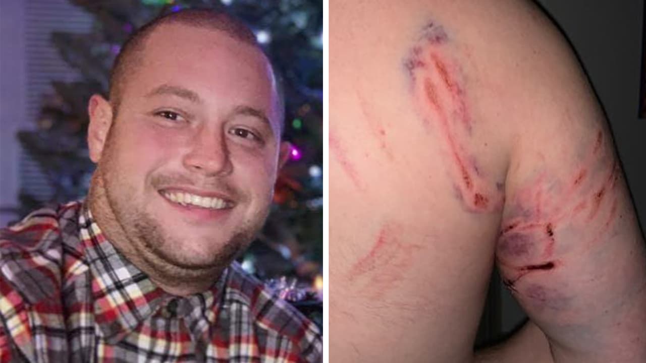 Hombre demanda a la ciudad de Baytown tras ser mordido varias veces por un perro policía