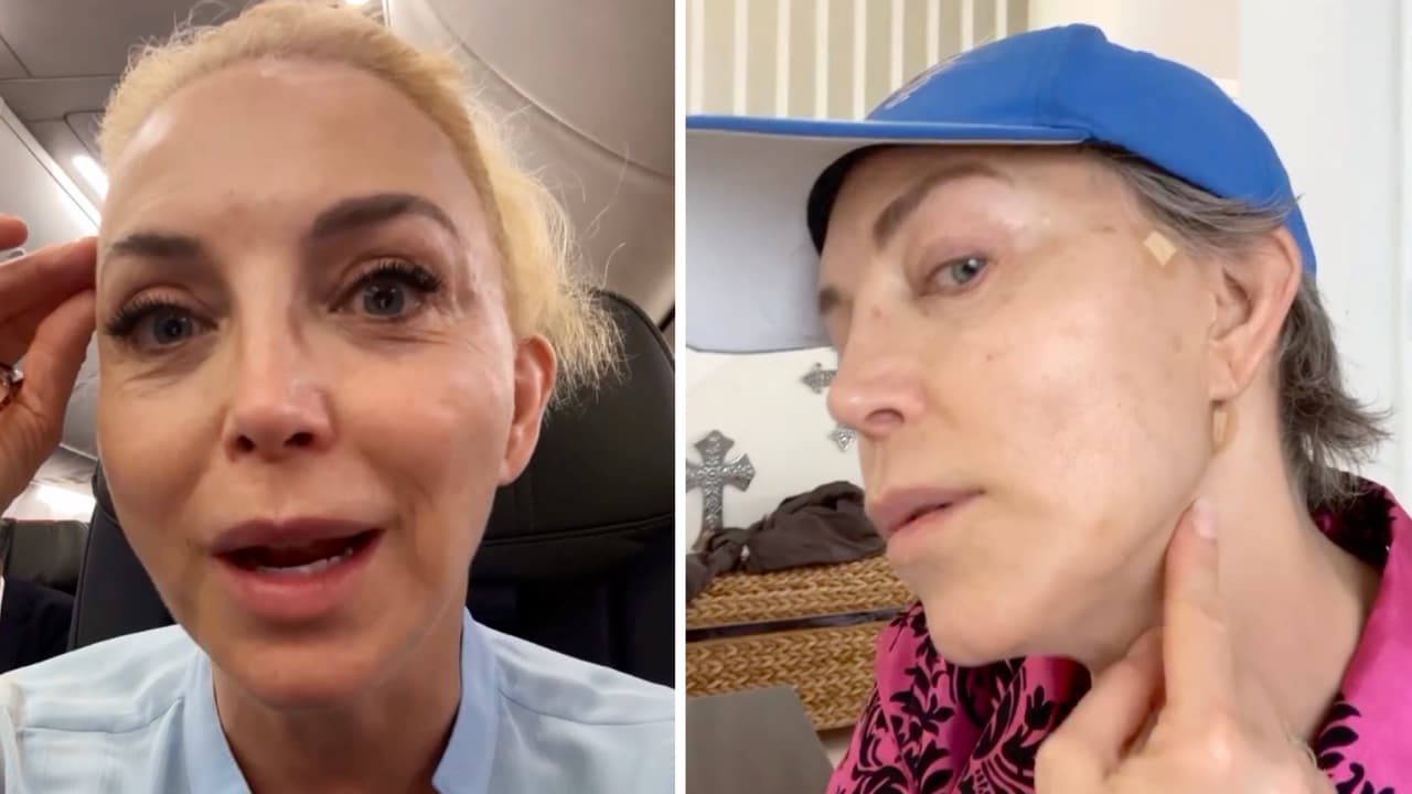 Laura Flores narra el terror que vivió con un ‘arreglito’ estético: “Parecía hámster”