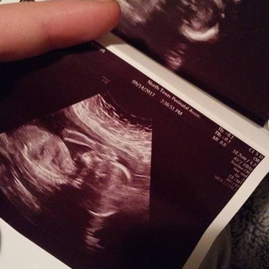 En su perfil de Facebook había compartido imágenes de sus sonogramas.