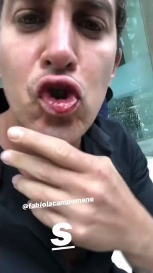 Más adelante, sentado en una banqueta, contó que había pedido ayuda a las autoridades y estaba esperando que llegaran para auxiliarlo.