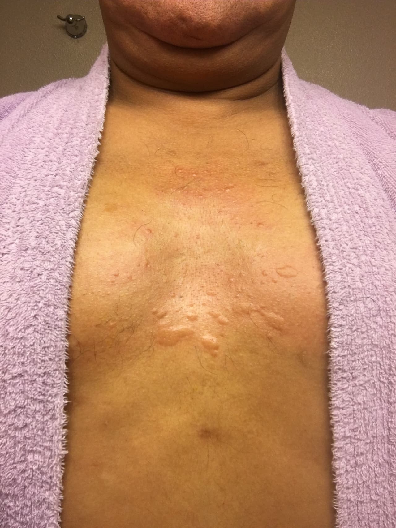 Por la foto, se ve que le quedó bastante irritado.