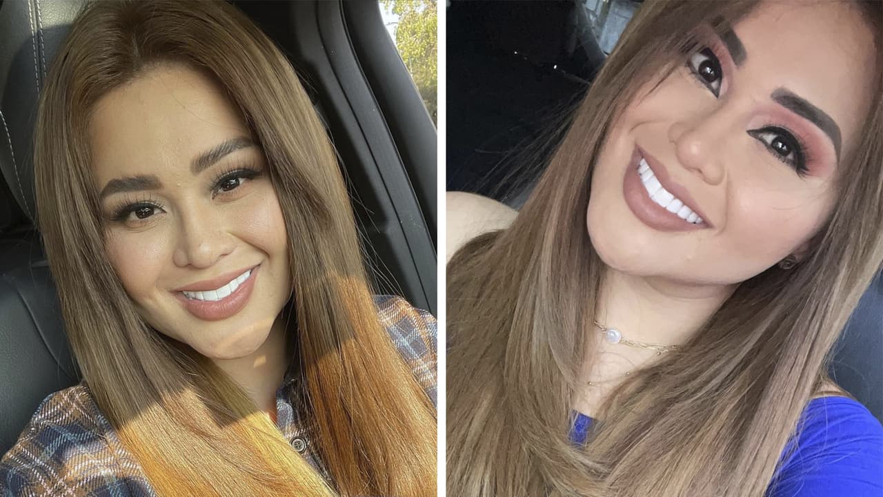 ¡Está irreconocible! Gomita muestra el antes y después de someterse a un bypass gástrico