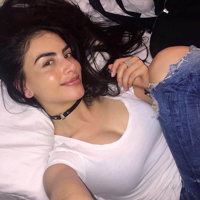 Se sometió a tres cirugías en donde un láser le derritió el plástico que se almacenaba entre el músculo y la piel. Afortunadamente la actriz ya se encuentra recuperada de este trago amargo.