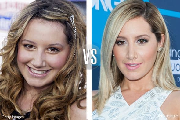Ashley Tisdale era tremendamente criticada por la forma de su nariz, así que decidió callar a todos y arreglarse. Clap, clap por ella.