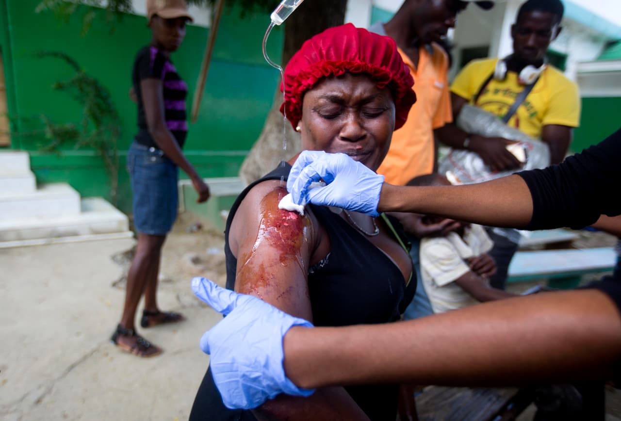 Una mujer que resultó herida en una de las réplicas del sismo es atendida por equipos de emergencia a las afueras del hospital.