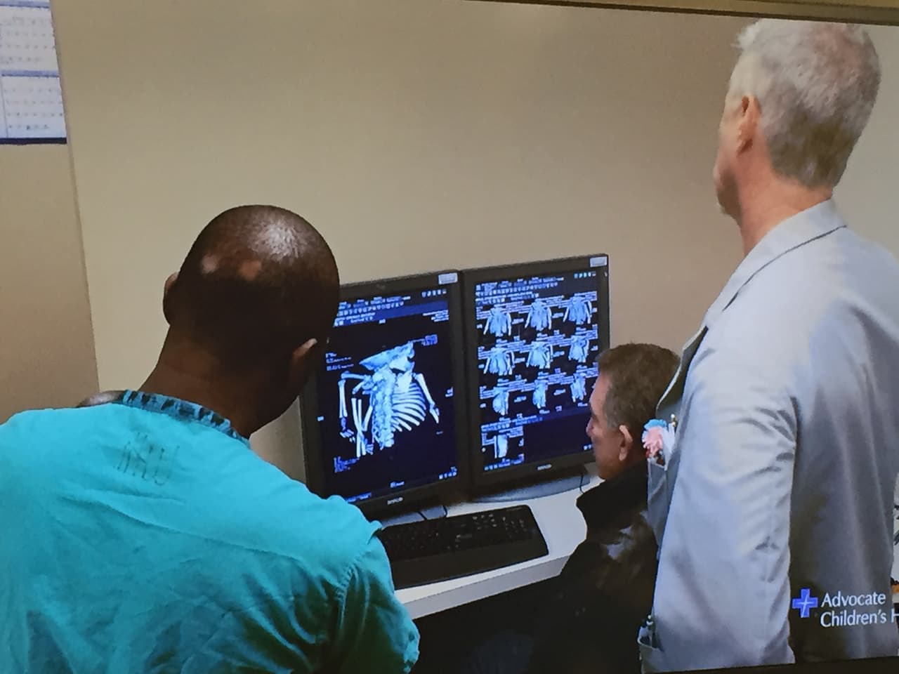 La menor, quien es originaria de Costa de Marfil, nació con cuatro pies y dos espinas dorsales, ya que tenía un gemelo parásito en el cuerpo.