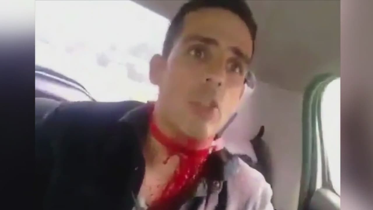 "Me gritaban sapo (soplón)": el periodista venezolano herido en el plebiscito cuenta cómo fue agredido