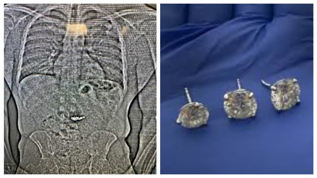 Recuperan joyas de Tiffany valoradas en $770,000 que un ladrón se tragó en su huida