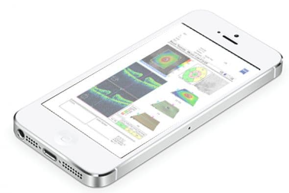 Ahora los iPhones pod´ran hacer pruebas oftalmológicas para detectar glaucoma.