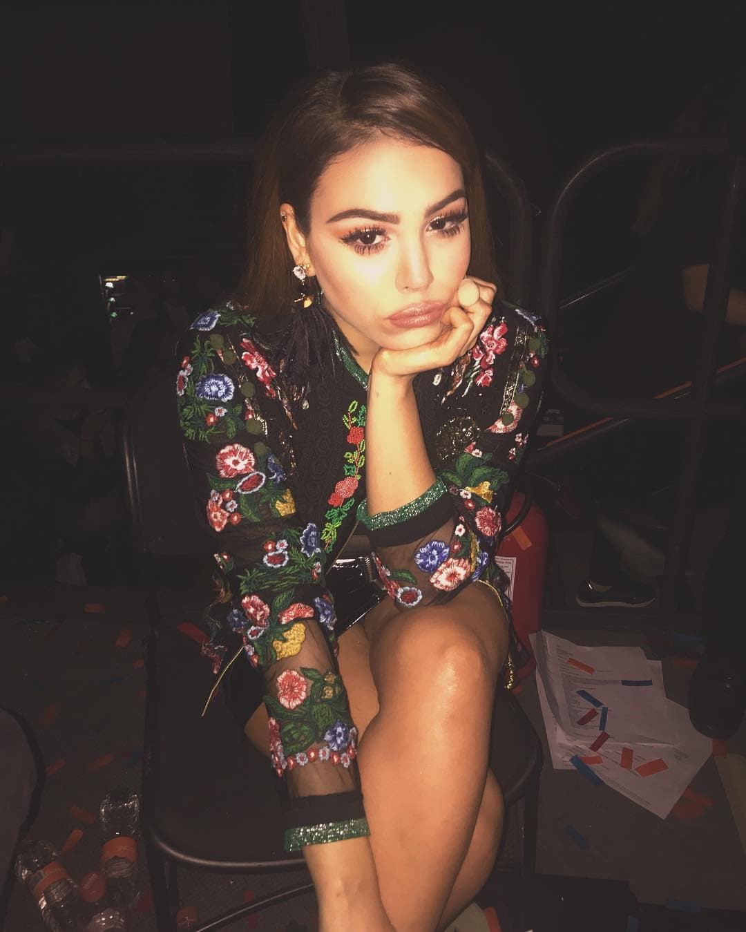 Recientemente la intérprete de 'Patito' compartió esta imagen en Instagram y causó gran polémica por el tamaño de sus labios, pues se veían mucho más hinchados de lo normal. Esto desató un sinfín de comentarios entre sus seguidores, los cuales le pedían que ya no se hiciera ningún arreglo en el rostro.