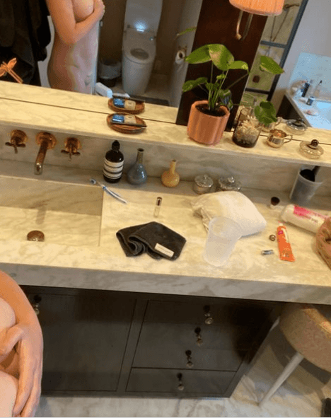 En este sentido, un año y medio después de someterse a una cesárea para traer a este mundo a su hijo Gene David, Schmer decidió mostrar la cicatriz de esta operación.