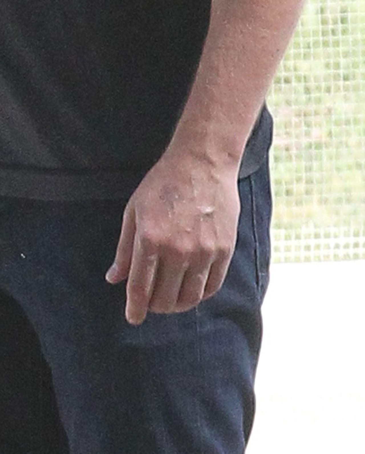 Su mano sin la argolla.