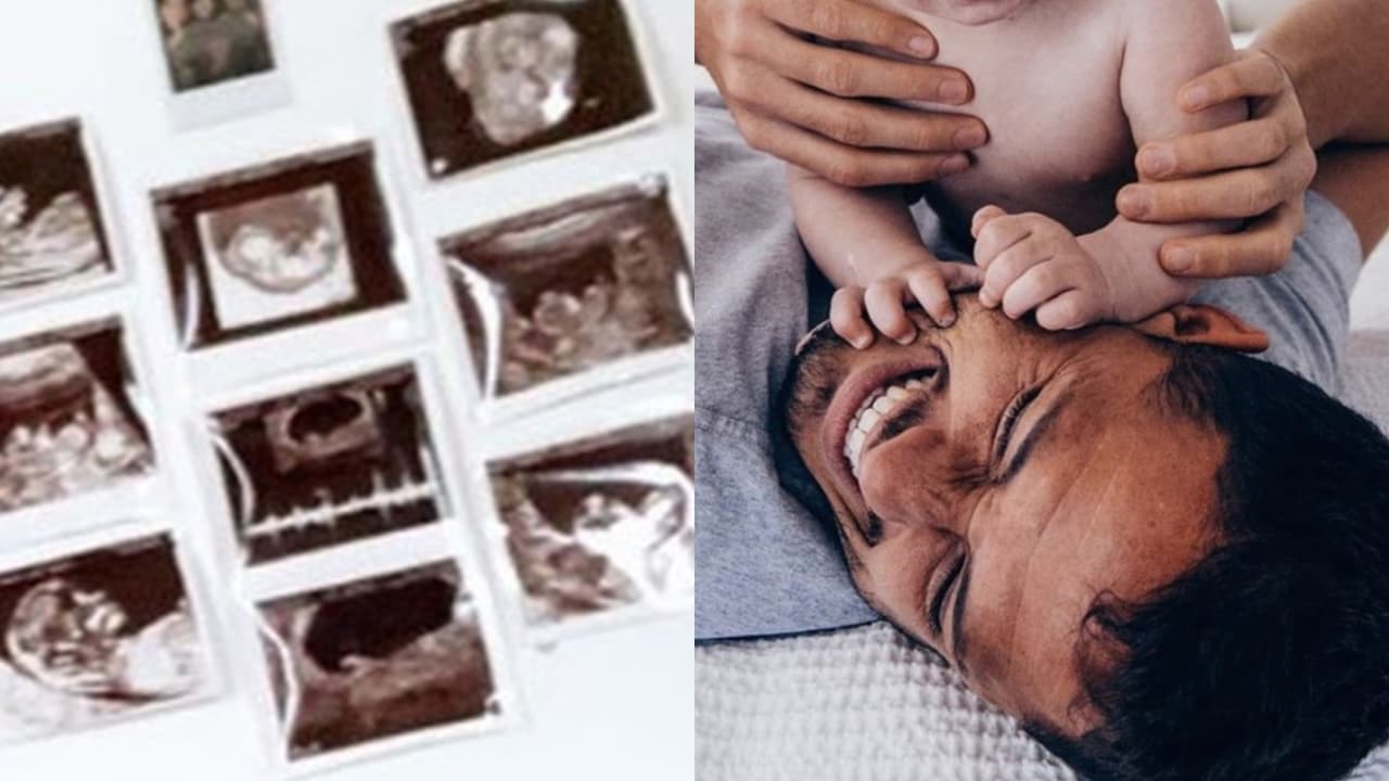 ¿Chicharita? El ultrasonido del nuevo bebé de Javier Hernández