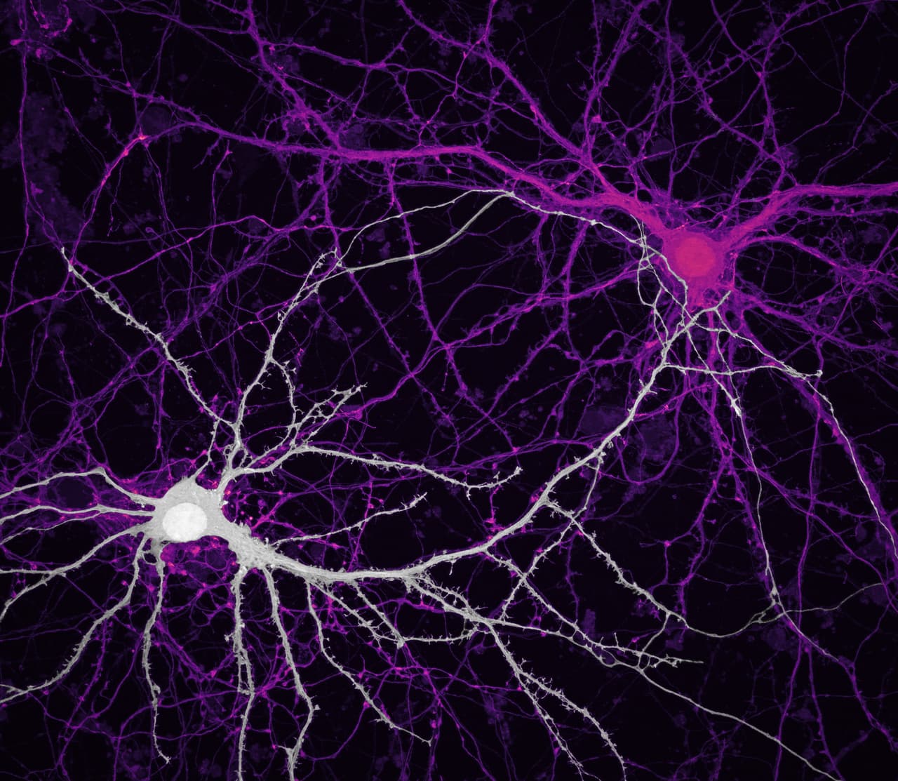 <b>Conexión entre neuronas del hipocampo</b> (células cerebrales). Ganó el noveno lugar.