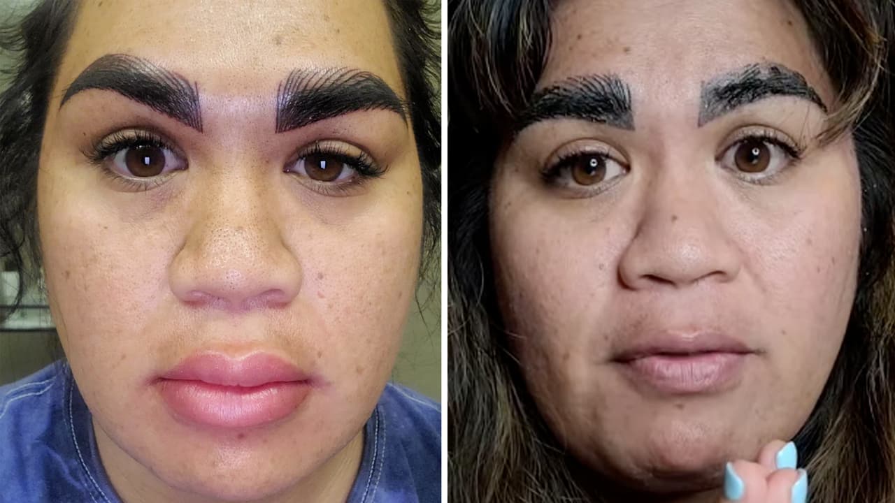 Con sus cejas como evidencia, una madre advierte de los peligros del maquillaje semipermanente