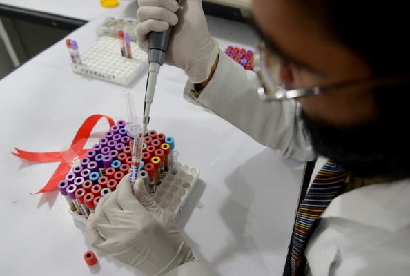 Descubren variante más agresiva y contagiosa del VIH: una advertencia para la pandemia de covid-19