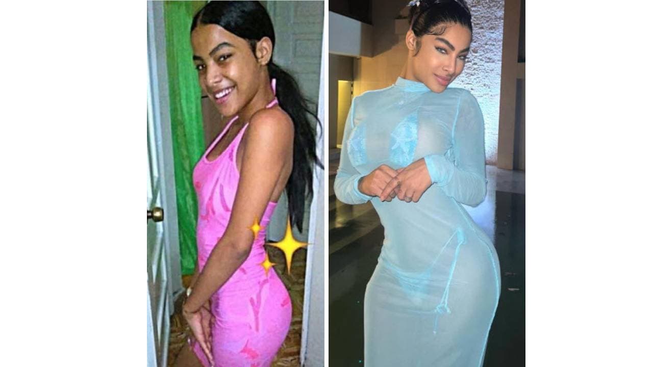 Yailin La Más Viral antes y después de sus cirugías estéticas.