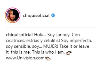 Sin embargo, en repetidas ocasiones ha demostrado que está orgullosa de ellas, así lo demostró en una entrevista exclusiva para
<a href="https://www.univision.com/entretenimiento/yo-soy-janney-la-verdad-desnuda-de-chiquis-rivera">Univision Entretenimiento</a>.