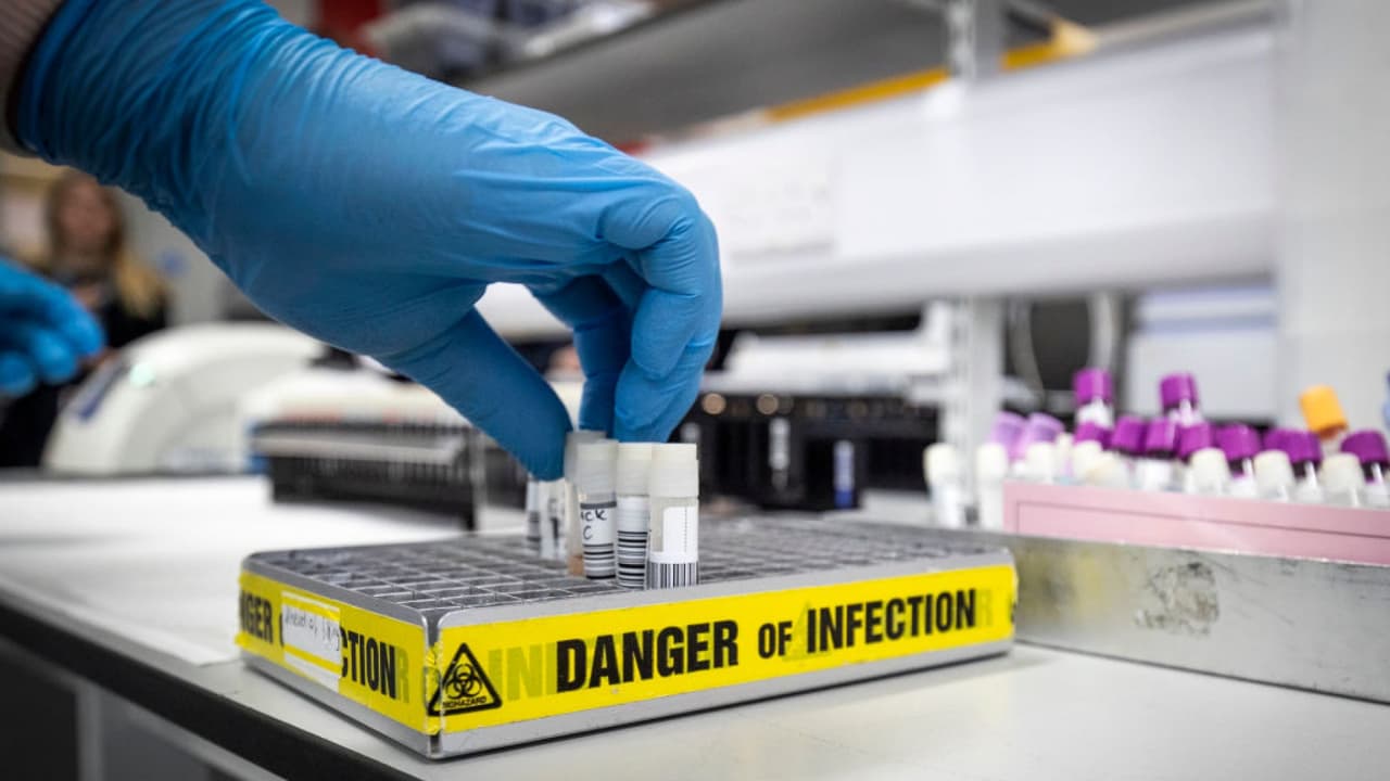 Examinan a otros dos pacientes por posible coronavirus en la ciudad de Nueva York